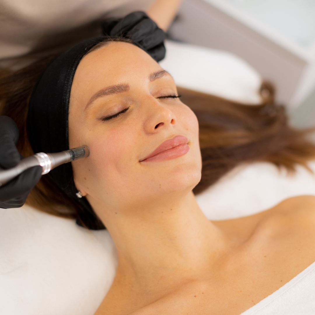 Microneedling Facial