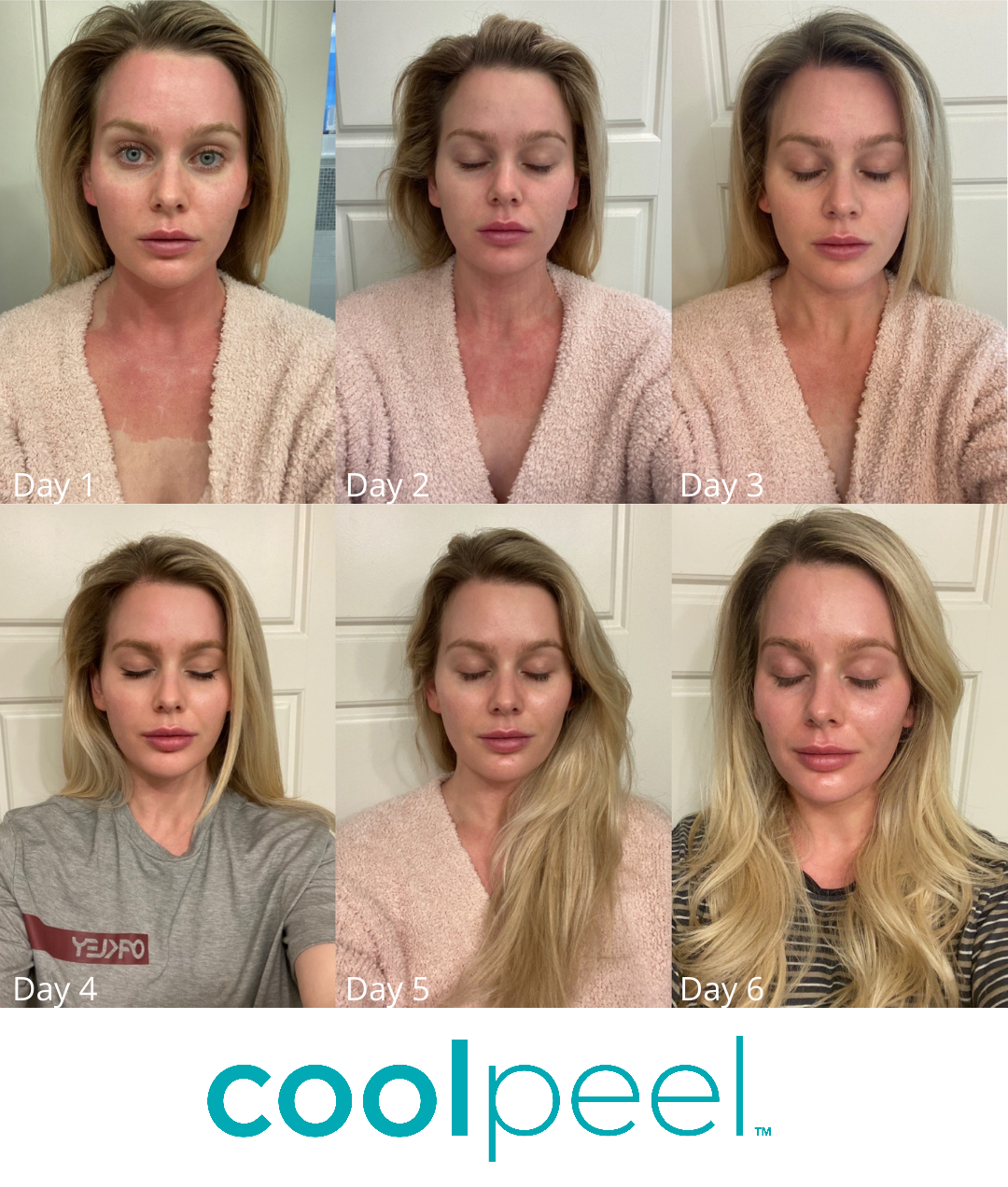 CoolPeel