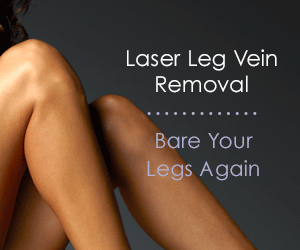 Laser Vein Therapy